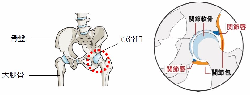 股関節唇損傷とは